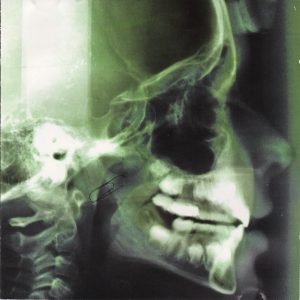 Apulanta: Aivan kuin kaikki muutkin (Levy-yhtiö 1998).